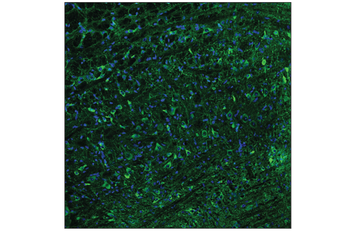  Image 52: Tau Mouse Model Neuronal Viability IF Antibody Sampler Kit