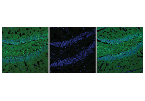  Image 56: Tau Mouse Model Neuronal Viability IF Antibody Sampler Kit