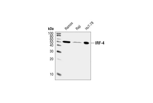 Western Blotting Image 2: IRF-4 Antibody