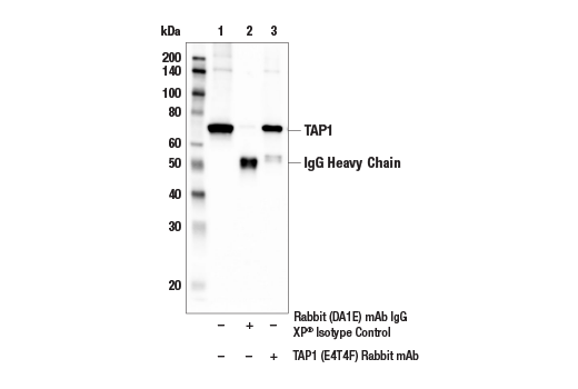Immunoprecipitation Image 1: TAP1 (E4T4F) Rabbit mAb