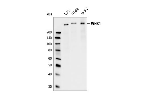Western Blotting Image 1: WNK1 Antibody