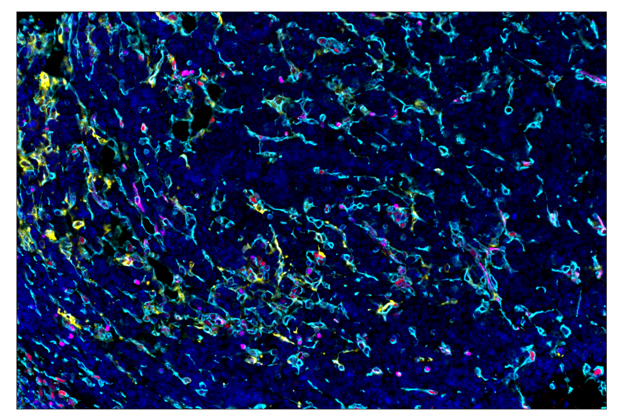 Immunohistochemistry Image 10: Vimentin (D21H3) & CO-0012-488 SignalStar™ Oligo-Antibody Pair
