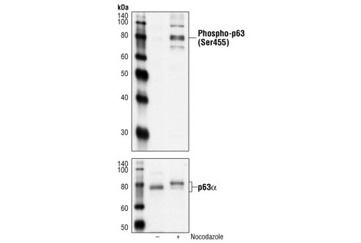 Western Blotting Image 1: Phospho-p63 (Ser455) Antibody