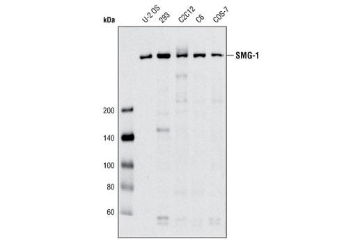 Western Blotting Image 1: SMG-1 (Q25) Antibody