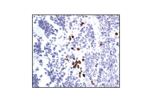 Immunohistochemistry Image 3: UBC3B Antibody