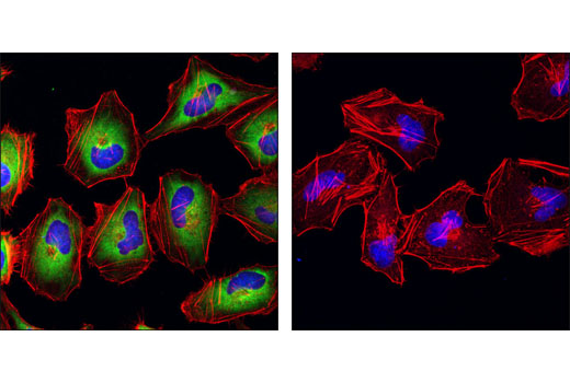 Immunofluorescence Image 1: Phospho-S6 Ribosomal Protein (Ser240/244) (D68F8) XP® Rabbit mAb (Alexa Fluor® 488 Conjugate)