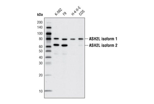  Image 7: Lysine Methyltransferase Antibody Sampler Kit