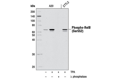 Western Blotting Image 1: Phospho-RelB (Ser552) (D41B9) XP® Rabbit mAb (BSA and Azide Free)