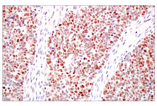 Immunohistochemistry Image 6: DNMT1 (D63A6) XP® Rabbit mAb (BSA and Azide Free)