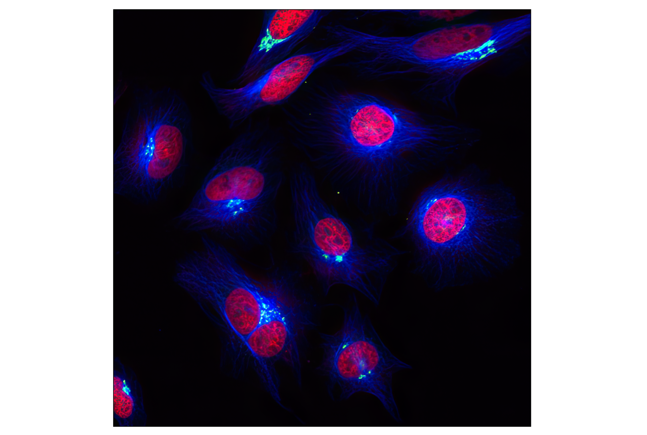 Immunofluorescence Image 1: α-Tubulin (11H10) Rabbit mAb (Alexa Fluor® 647 Conjugate)