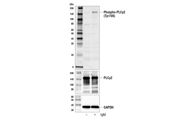  Image 3: PhosphoPlus® PLCγ2 (Tyr759) Antibody Duet