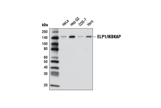 Western Blotting Image 1: ELP1/IKBKAP Antibody