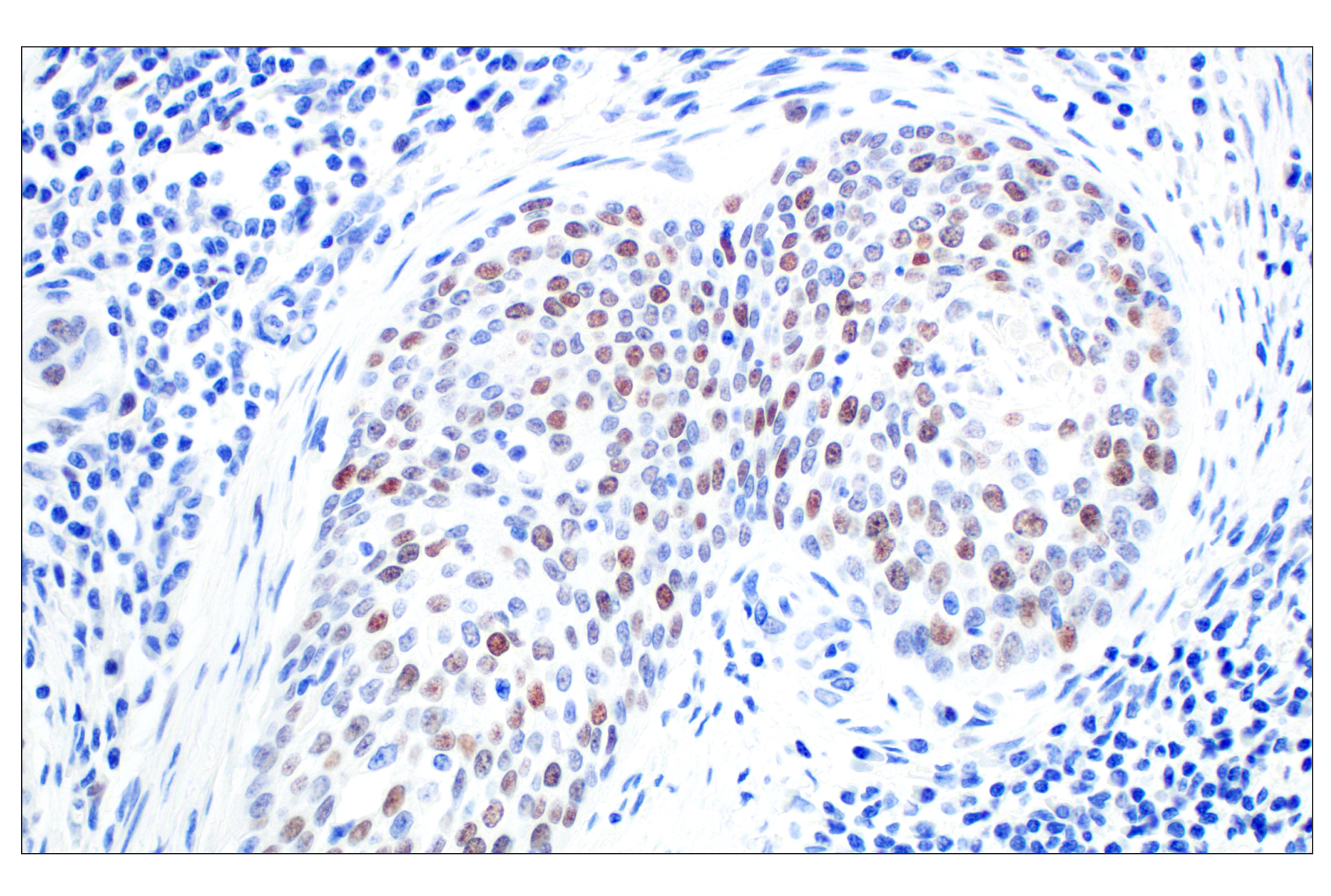 Immunohistochemistry Image 3: BRCA1 (E5S9G) Rabbit mAb