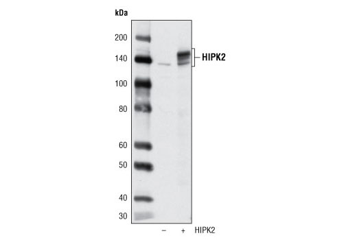 Western Blotting Image 1: HIPK2 Antibody