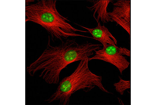 Immunofluorescence Image 1: RCC2 (D14F3) Rabbit mAb