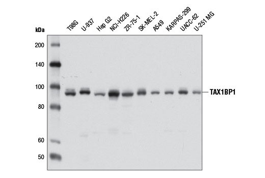  Image 1: SQSTM1/p62-like Receptor Antibody Sampler Kit