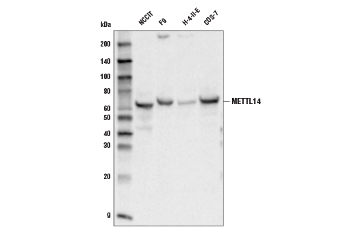  Image 2: N6-mA Methyltransferase Antibody Sampler Kit
