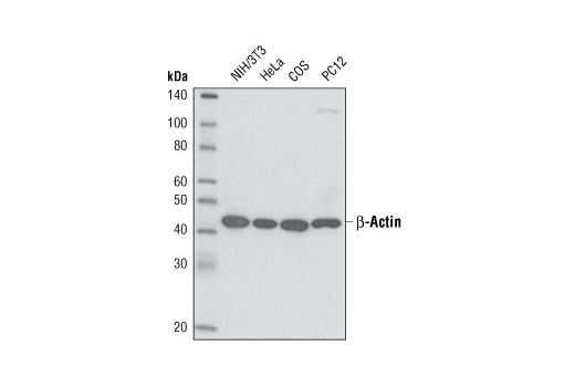 Western Blotting Image 1: β-Actin (13E5) Rabbit mAb (HRP Conjugate)