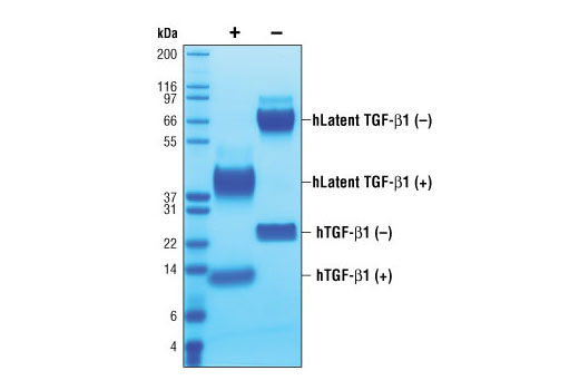  Image 2: Human Latent Transforming Growth Factor β1 (hLatent TGF-β1)