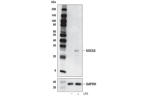  Image 17: Jak/Stat Pathway Inhibitors Antibody Sampler Kit