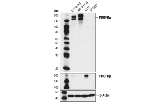 Western Blotting Image 1: PDGF Receptor α (D13C6) XP® Rabbit mAb (BSA and Azide Free)