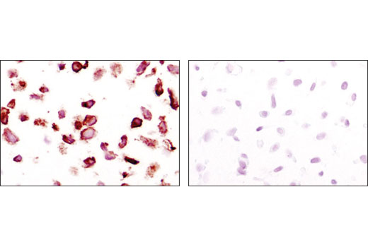 Immunohistochemistry Image 1: PDGF Receptor α (D13C6) XP® Rabbit mAb (BSA and Azide Free)