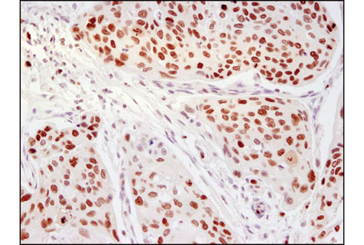  Image 17: PhosphoPlus® Ezh2 (Thr345) Antibody Duet
