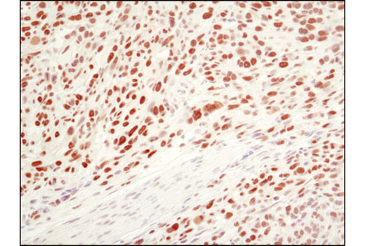  Image 19: PhosphoPlus® Ezh2 (Thr345) Antibody Duet