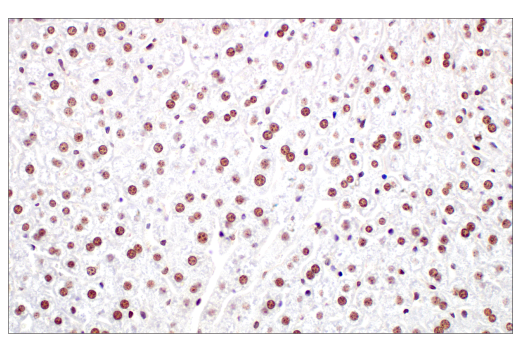 Immunohistochemistry Image 8: Ezh2 (D2C9) XP® Rabbit mAb