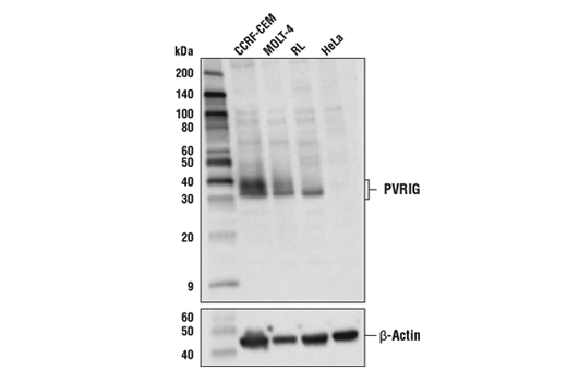 Western Blotting Image 1: PVRIG Antibody