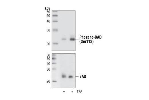  Image 4: Phospho-Bad Antibody Sampler Kit