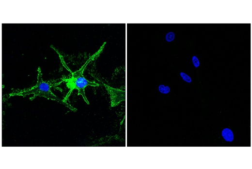 Immunofluorescence Image 1: CD81 (E2K9V) Rabbit mAb (BSA and Azide Free)