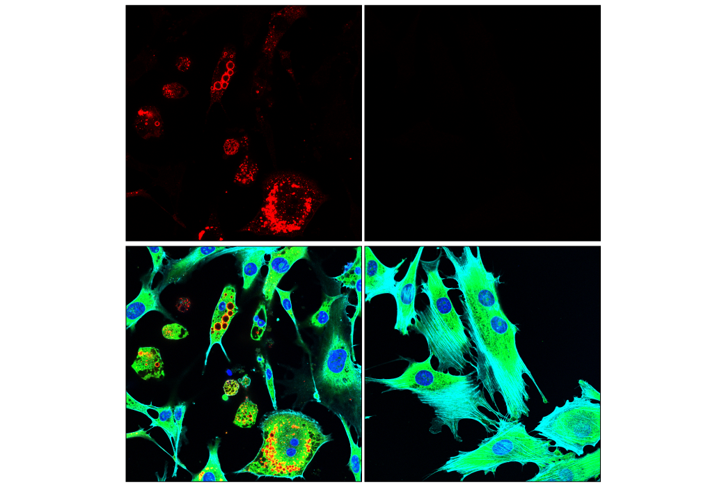 Immunofluorescence Image 2: Perilipin-1 (D1D8) XP® Rabbit mAb (Alexa Fluor® 647 Conjugate)