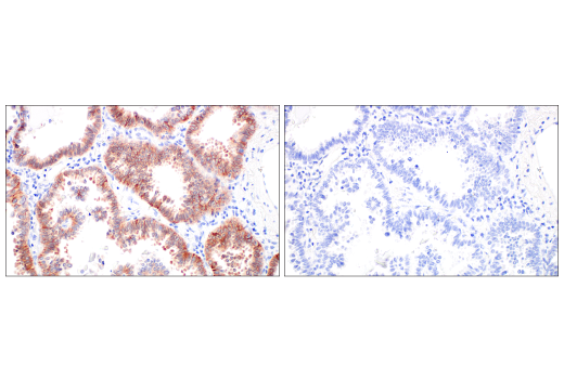 Immunohistochemistry Image 11: Integrin β6 (E4M9P) XP® Rabbit mAb (BSA and Azide Free)