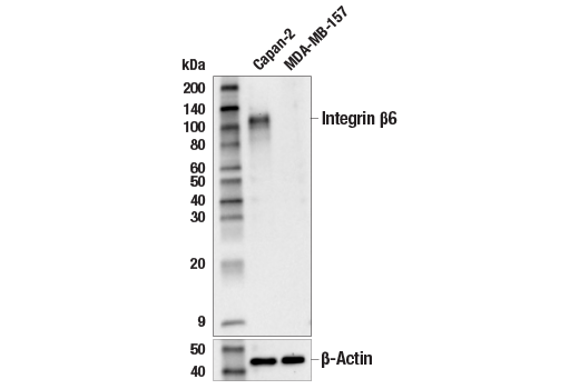Western Blotting Image 1: Integrin β6 (E4M9P) XP® Rabbit mAb (BSA and Azide Free)