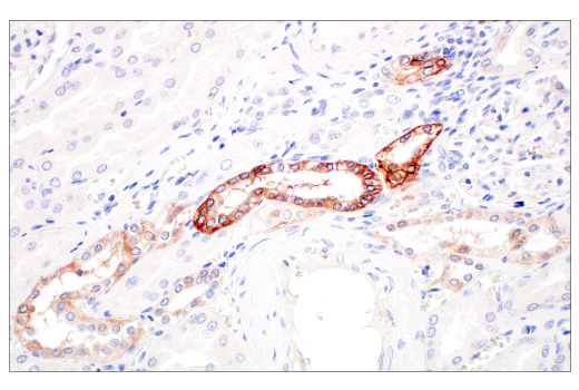 Immunohistochemistry Image 10: Integrin β6 (E4M9P) XP® Rabbit mAb (BSA and Azide Free)