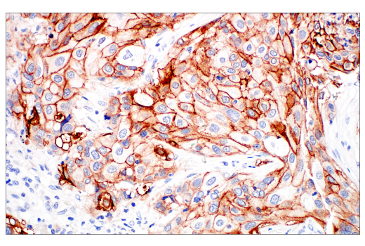 Immunohistochemistry Image 5: Integrin β6 (E4M9P) XP® Rabbit mAb (BSA and Azide Free)