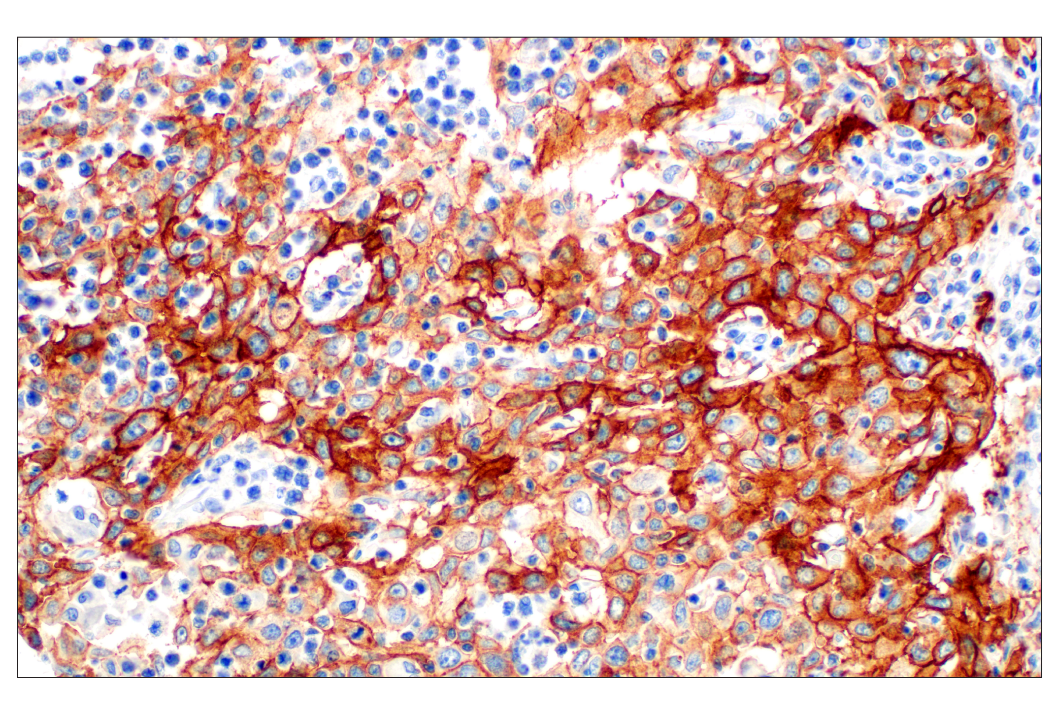 Immunohistochemistry Image 3: Integrin β6 (E4M9P) XP® Rabbit mAb (BSA and Azide Free)