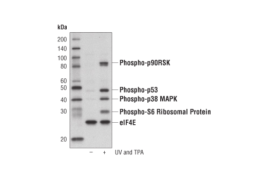 Western Blotting Image 1: PathScan® Multiplex Western Cocktail II: Phospho-p90RSK, Phospho-p53, Phospho-p38 MAPK and Phospho-S6 Ribosomal Protein Detection Cocktail II