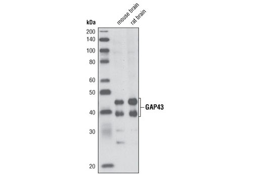 Western Blotting Image 1: GAP43 Antibody