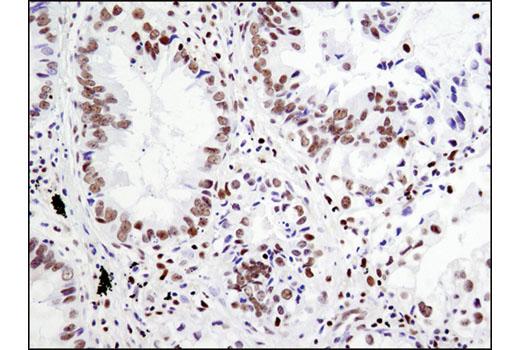  Image 37: Notch Activated Targets Antibody Sampler Kit