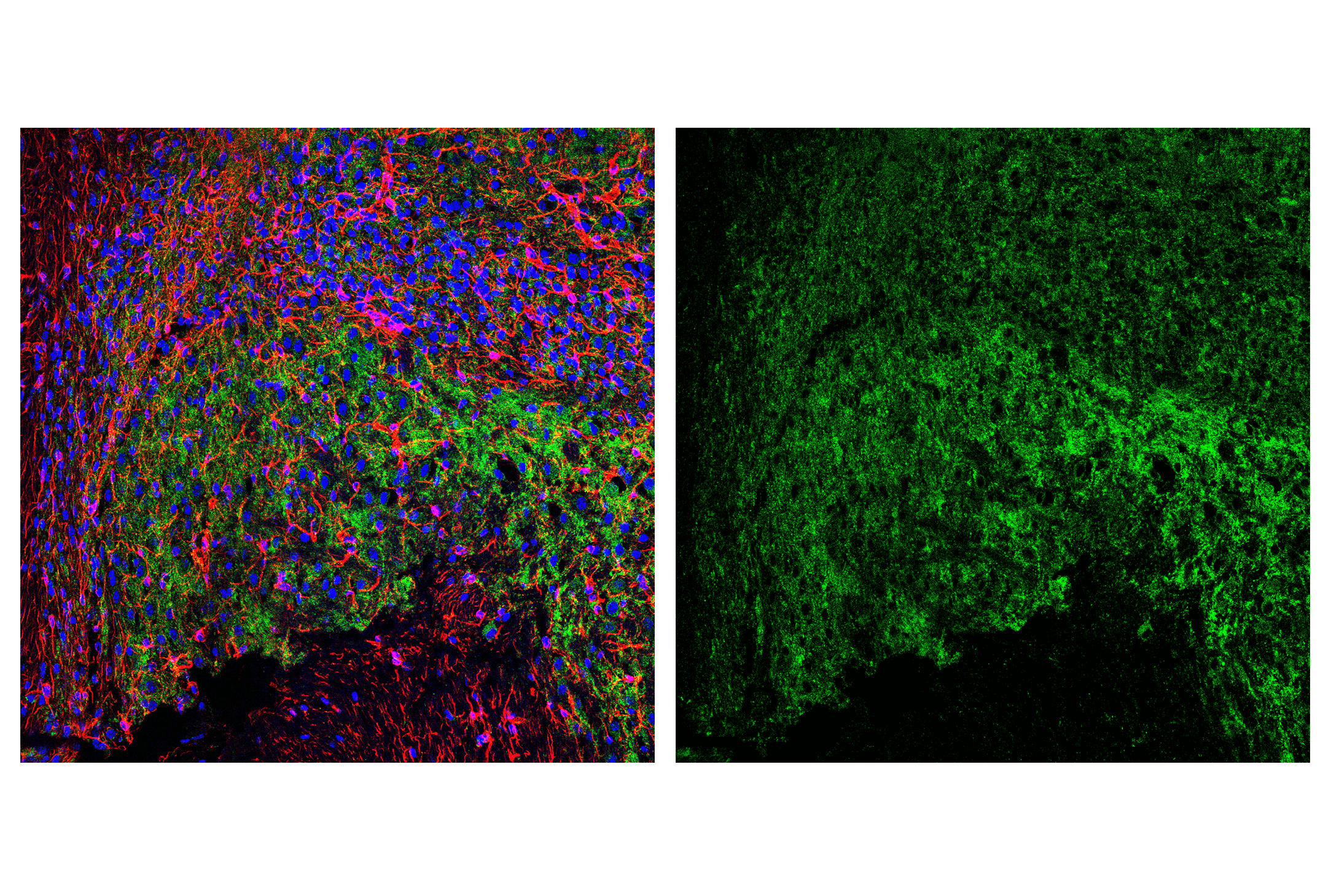 Immunofluorescence Image 1: AIF (D39D2) XP® Rabbit mAb