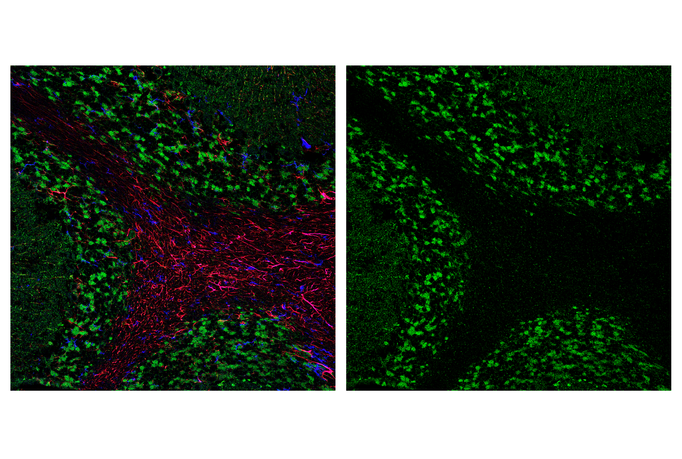 Immunofluorescence Image 2: AIF (D39D2) XP® Rabbit mAb