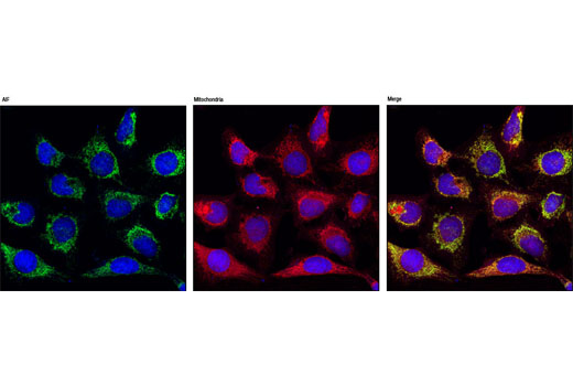 Immunofluorescence Image 6: AIF (D39D2) XP® Rabbit mAb