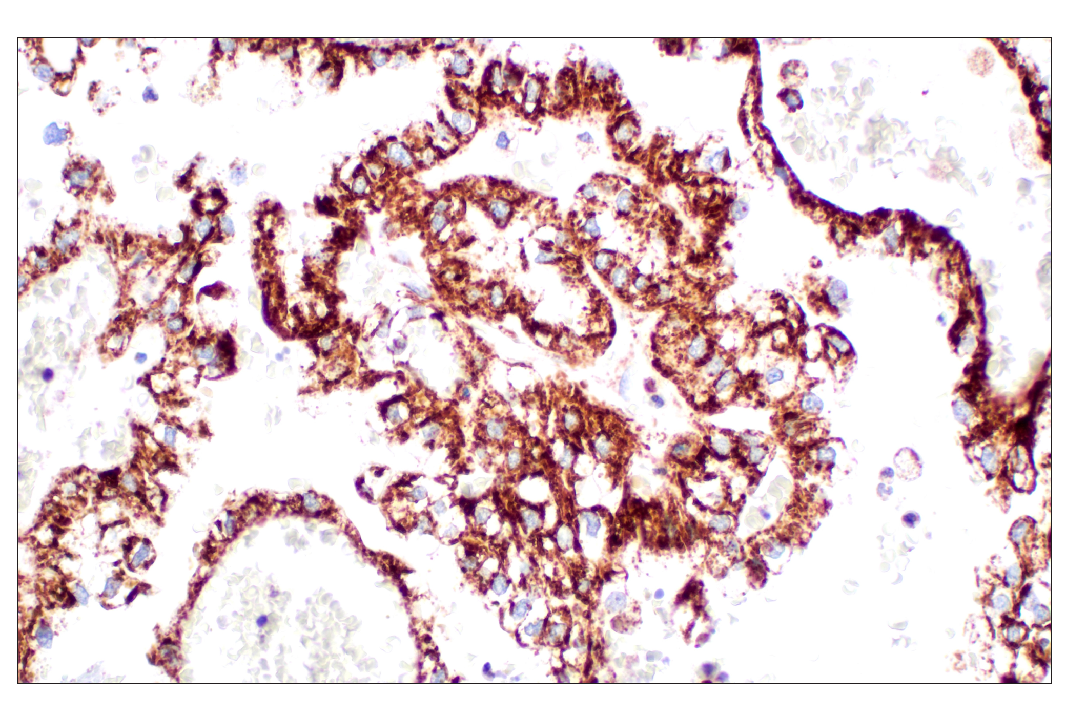  Image 23: Organelle Localization IF Antibody Sampler Kit
