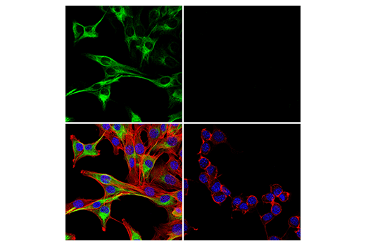 Immunofluorescence Image 5: Desmin (D93F5) XP® Rabbit mAb