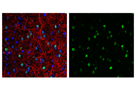 Immunofluorescence Image 1: c-Fos (9F6) Rabbit mAb (BSA and Azide Free)
