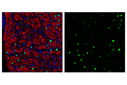 Immunofluorescence Image 2: c-Fos (9F6) Rabbit mAb (BSA and Azide Free)
