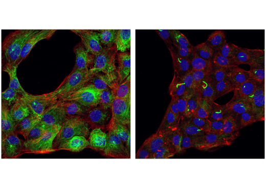 Immunofluorescence Image 2: Acetyl-α-Tubulin (Lys40) (D20G3) XP® Rabbit mAb