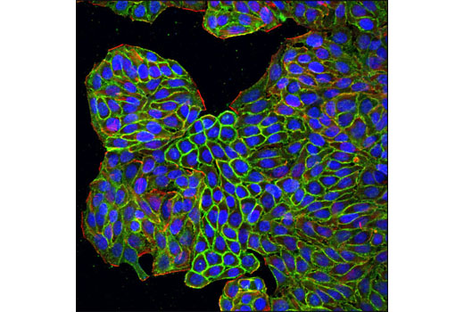 Immunofluorescence Image 1: ASCT2 (V501) Antibody